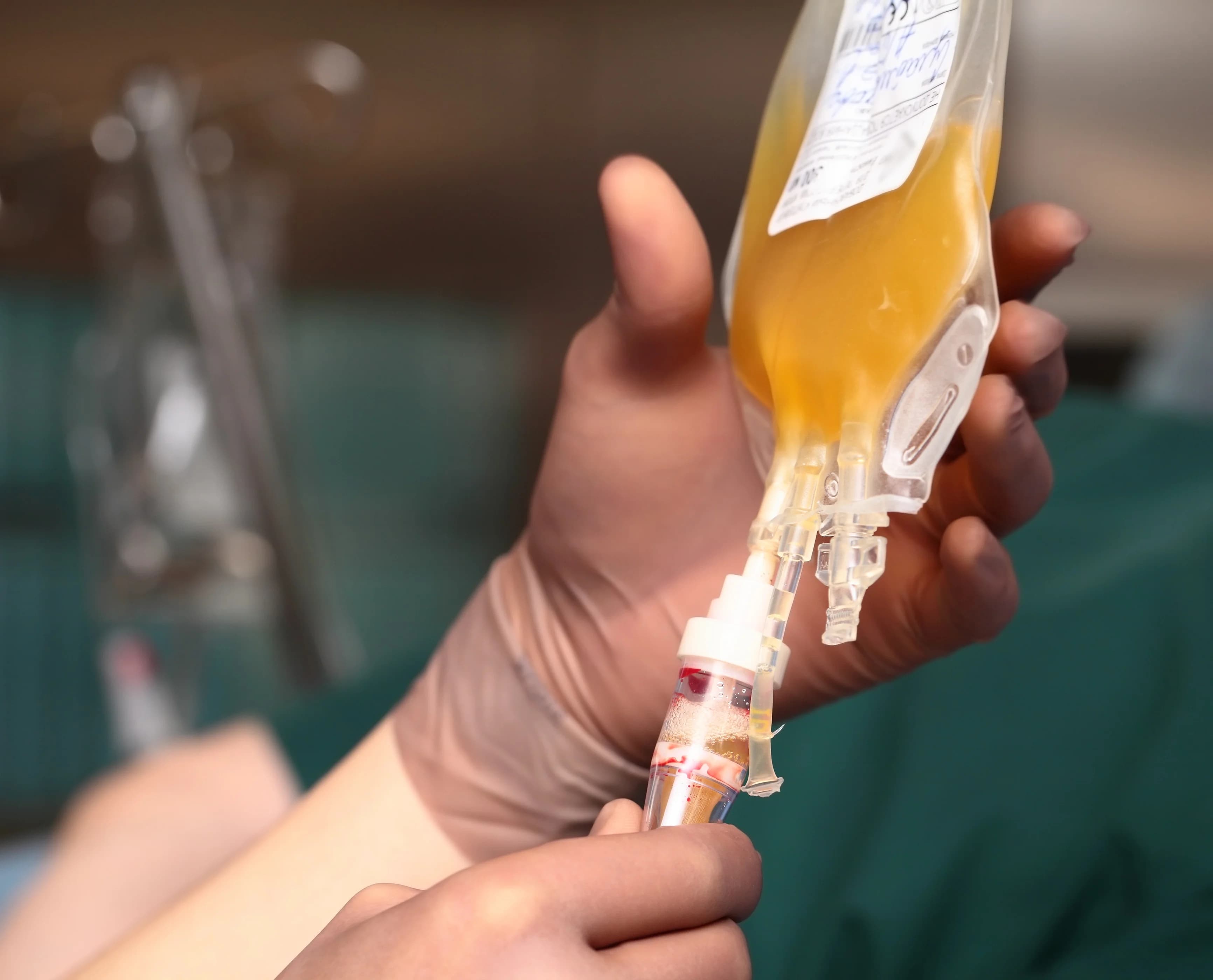 Phlebotomist handling bag of plasma